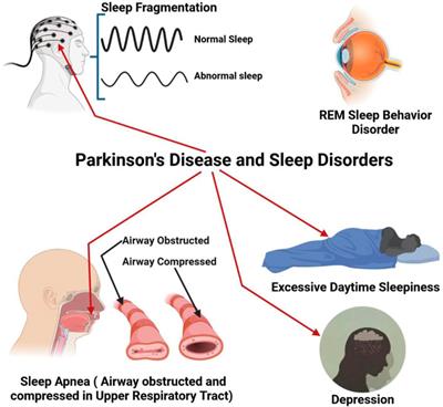 Multifunctional role of natural products for the treatment of Parkinson’s disease: At a glance